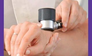 dermatoscopia